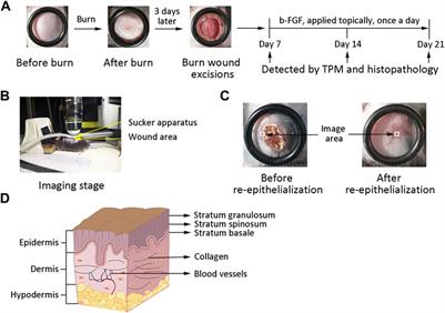 Assessing Skin Healing and Angiogenesis of Deep Burns in Vivo Using Two-Photon Microscopy in Mice